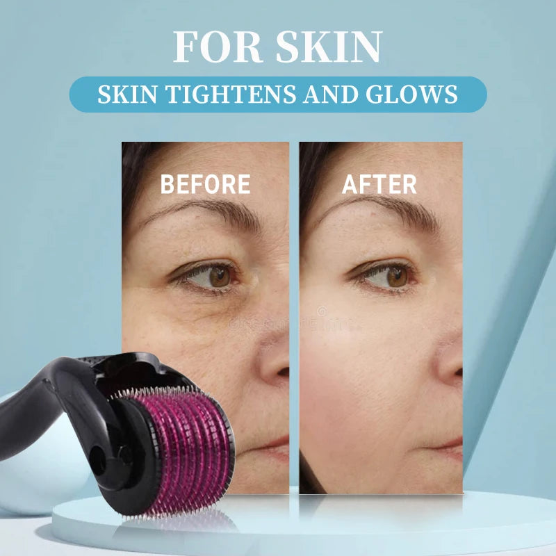 Titanium Microneedle Derma Roller 540 Pin Skin Tool