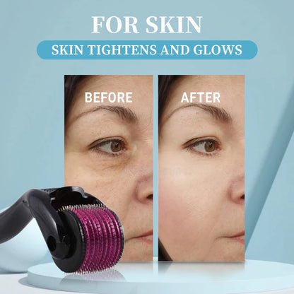 Titanium Microneedle Derma Roller 540 Pin Skin Tool
